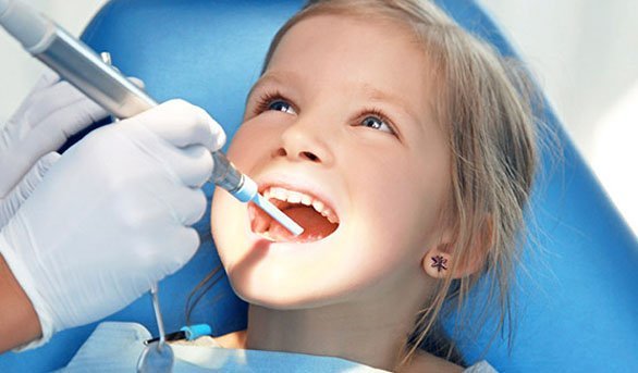 Çocukların Dişlerine Neden Bu Kadar Fazla Dolgu Gerekiyor ?